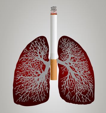 폐암 초기부터 폐암 말기까지 주요 증상 7가지와 생존율 알아보기